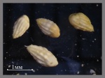 Foraminifera-50 _Bulimina